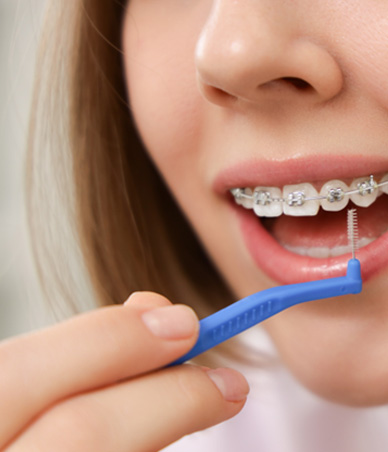 Girl with braces holding interdental brush