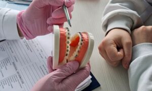 Doctor using model to answer questions about braces